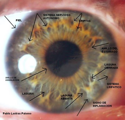 Iridologia: Signos del iris: debilidades, lagunas, criptas